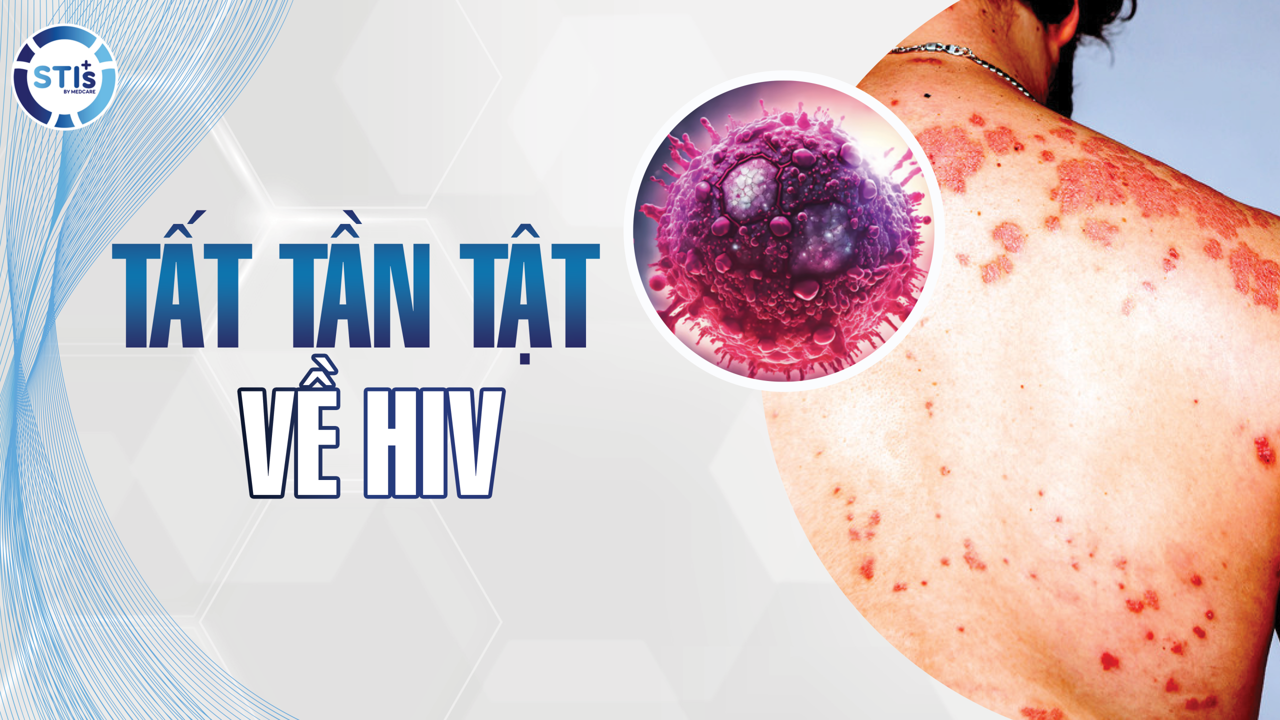 tat-ca-ve-HIV